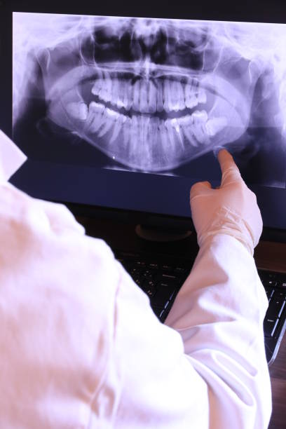 Best Dentist for Tooth Abscess  in Georgetown, IL